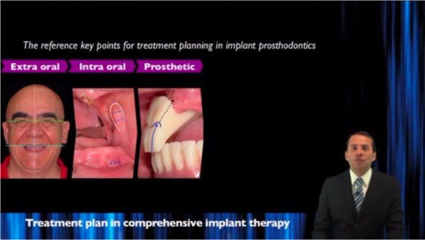 Treatment plan in comprensive surgical and prosthetic implant therapy