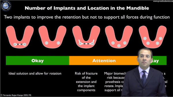 Overdentures